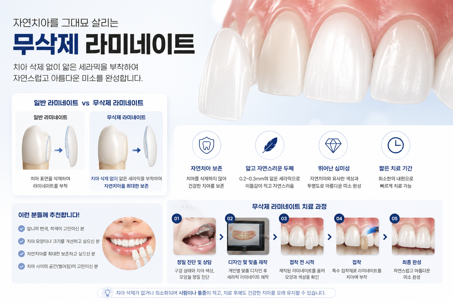 강남 무삭제 라미네이트 0~0.3mm 세라믹 적용 원리 — 오앤오치과 오회진 원장